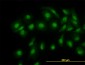CFL1 Antibody (monoclonal) (M04)